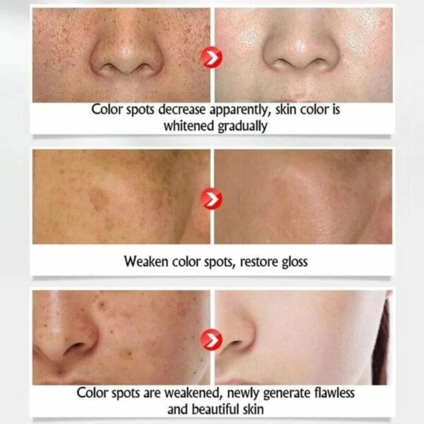 Rores Rice serum Rice skin Beauty Essence - Image 4
